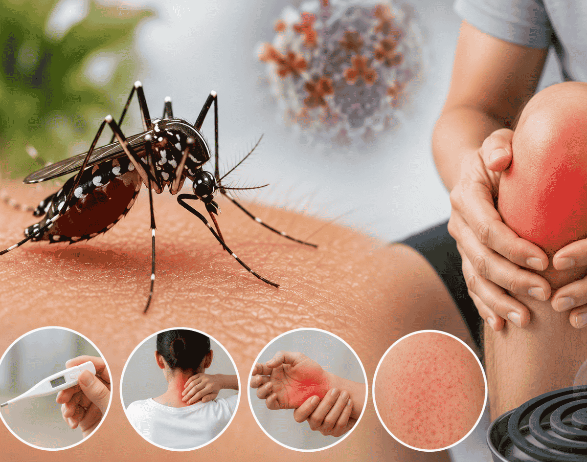 Salvador intensifica vigilância após crescimento de suspeitas de chikungunya em Castelo Branco 