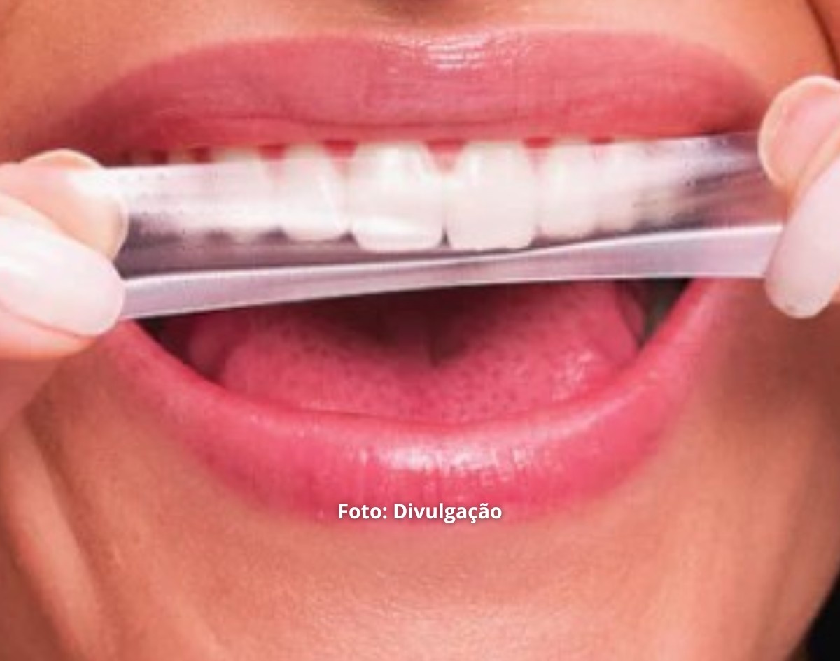 Anvisa manda recolher fitas de clareamento dental